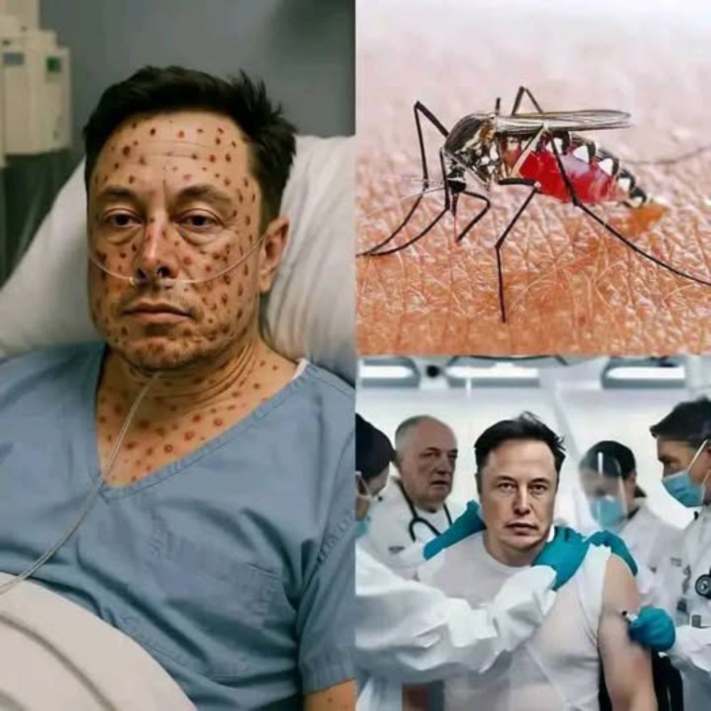 Global Shock! Elon Musk Was Discovered With Hundreds of Strange Red Spots on His Body After Being Bitten by a Poisonous Mosquito – Doctors Warn This Could Be a Mysterious Biological Experiment. AL